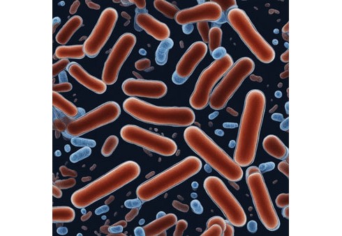 Bakterie E-Coli ve vodě - analýza problému. Co dělat? Bakterie E-Coli ve vodě - analýza problému. Co dělat?